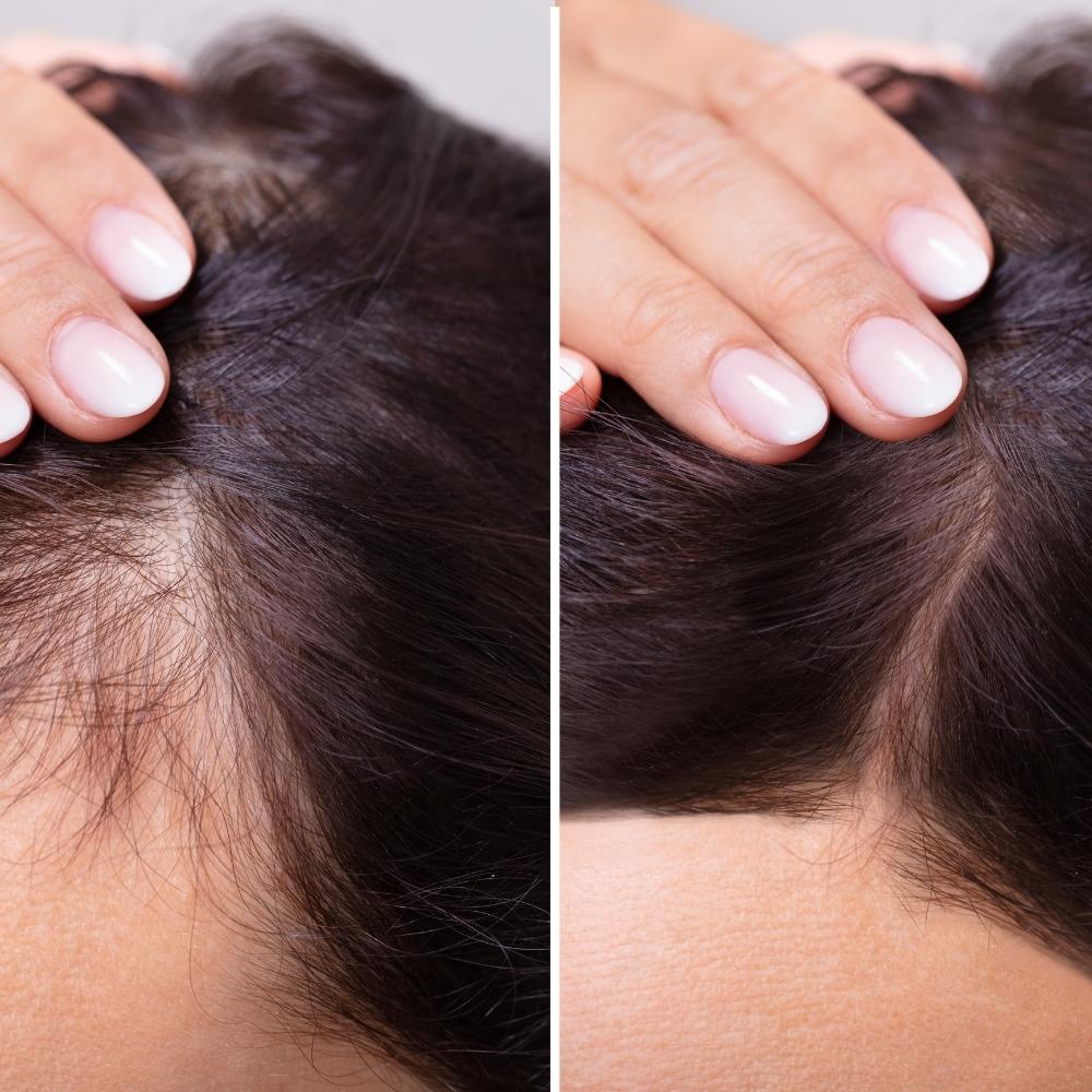 Cuir chevelu avant après traitement santé capillaire 2 mois SILKBIOTIC cheveux soie