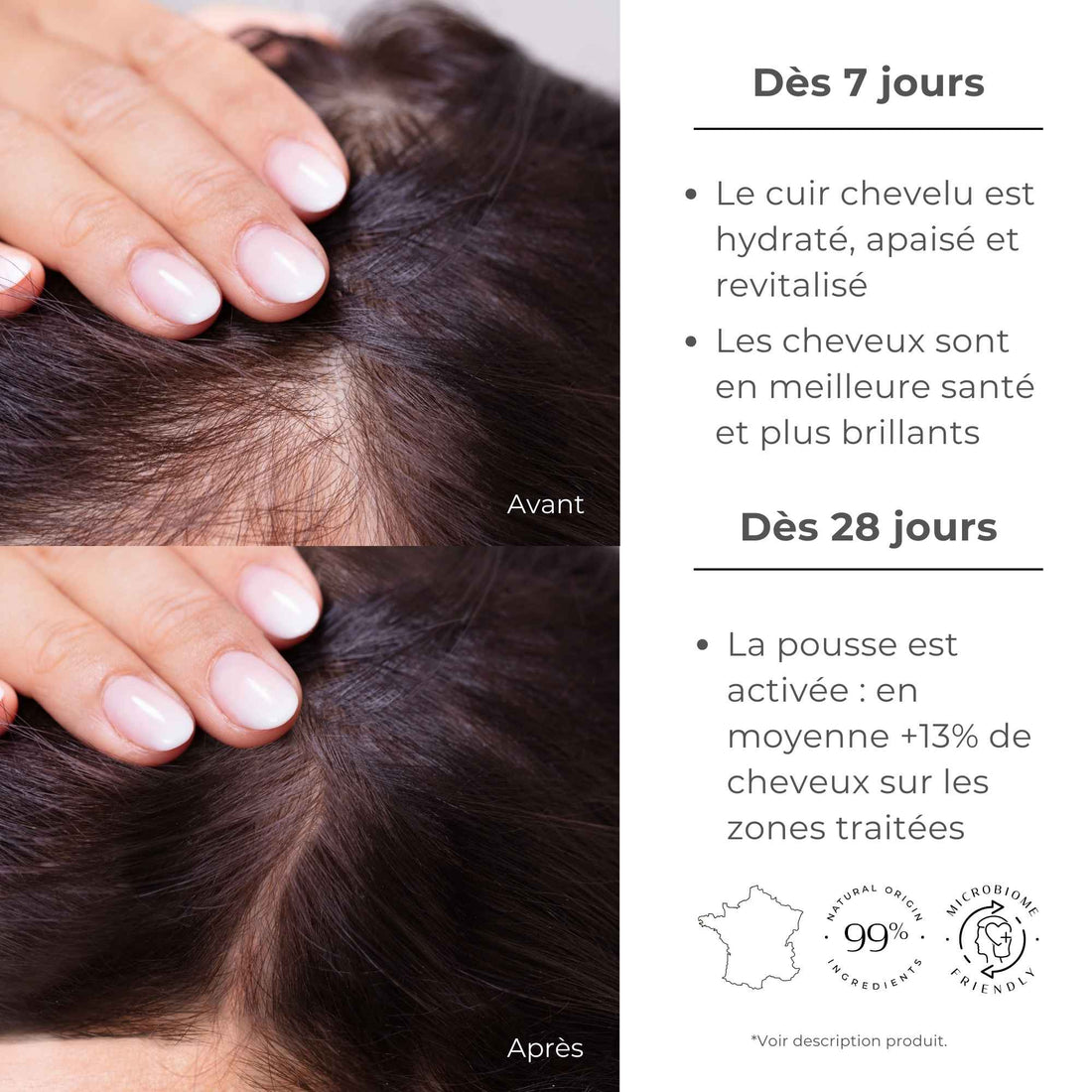 Avec le traitement santé capillaire 3 mois, les cheveux sont en meilleure santé et plus brillants. Le cuir chevelu, hydraté, apaisé et revitalisé. Optez pour les produits à base de soie avec SILKBIOTIC.